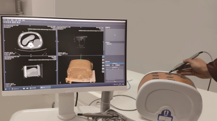 三维导航癌症消融手术模拟器