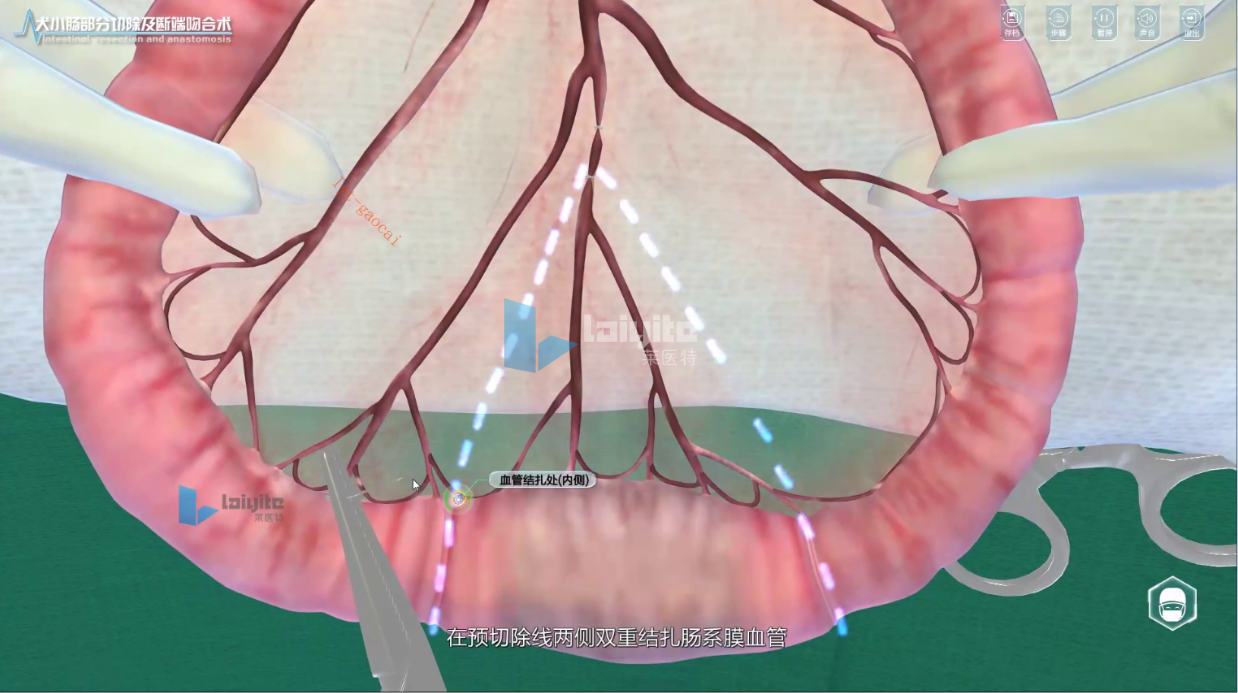 犬坏死肠管的切除与端端吻合仿真实训系统