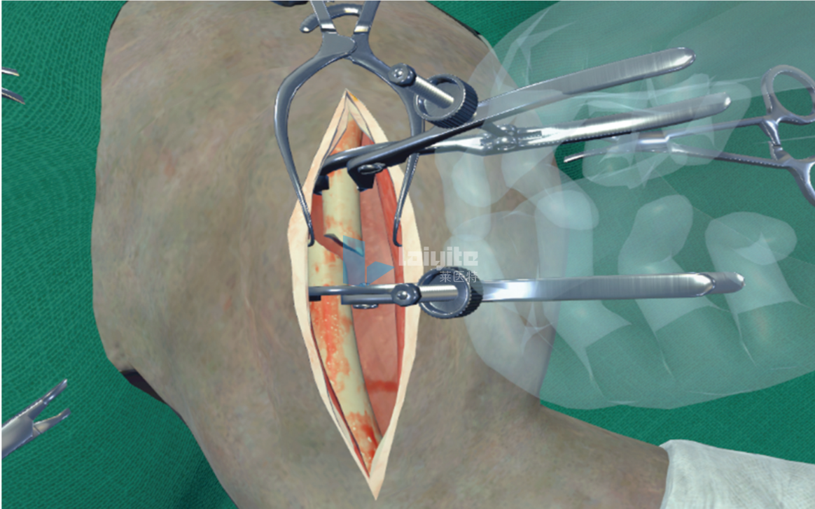 犬股骨骨折内固定术仿真实训系统